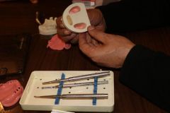 Maxillary Sinus Grafting_12