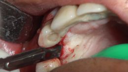 جراحی زنده - دکتر غلامی