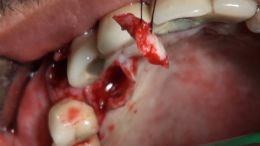 4-5-Mehr-98-Live-Surgery_2