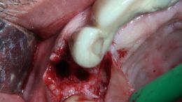 4-5-Mehr-98-Live-Surgery_4