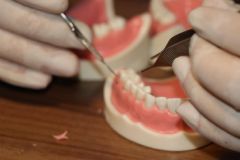 Periodontal_Crown_Length_Smile_Design_Course_July_2019_10