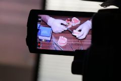 Periodontal_Crown_Length_Smile_Design_Course_July_2019_11