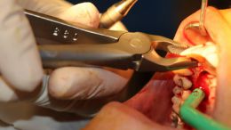 18 th International congress of Iranian association of oral and maxillofacial surgeons_25