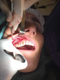Two days Plastic surgery course with live surgery