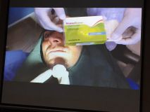 Implant and GBR course in Hamedan_7