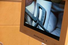 SPI system presentation with live surgery