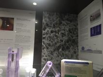 SPI system presentation with live surgery